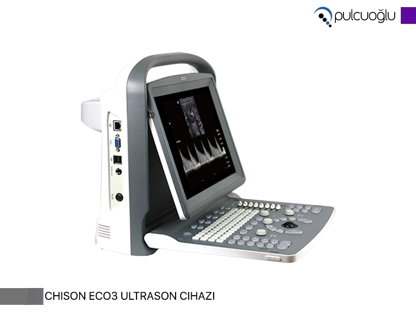 Chison ECO3 Ultrason Cihazları